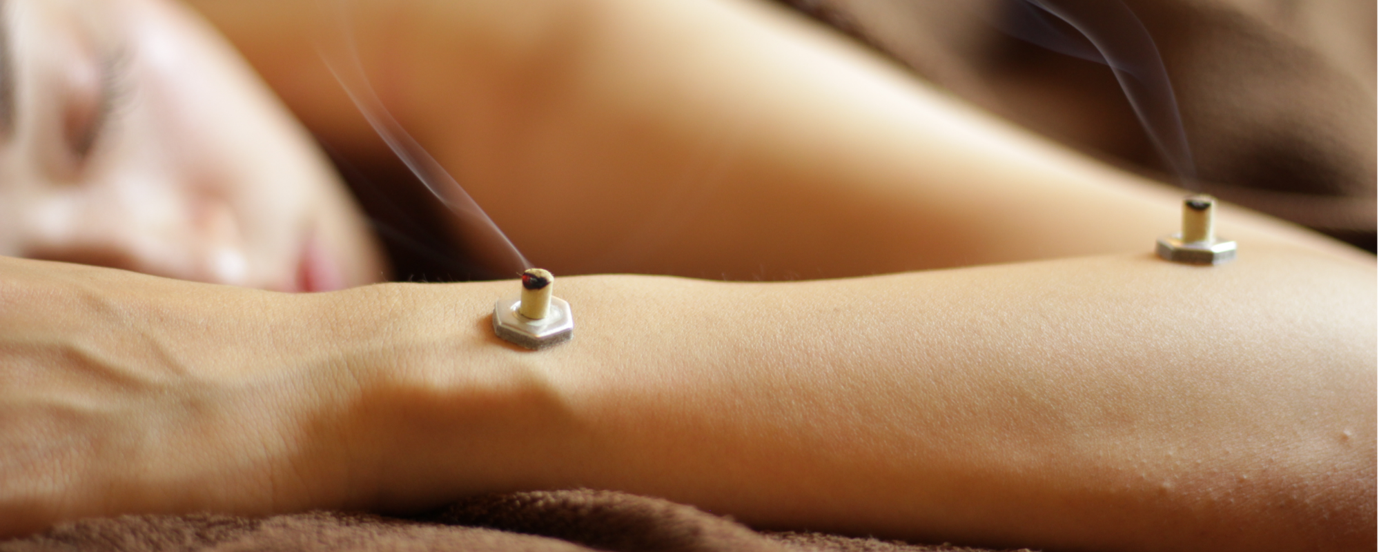 美容鍼灸サロン_温灸