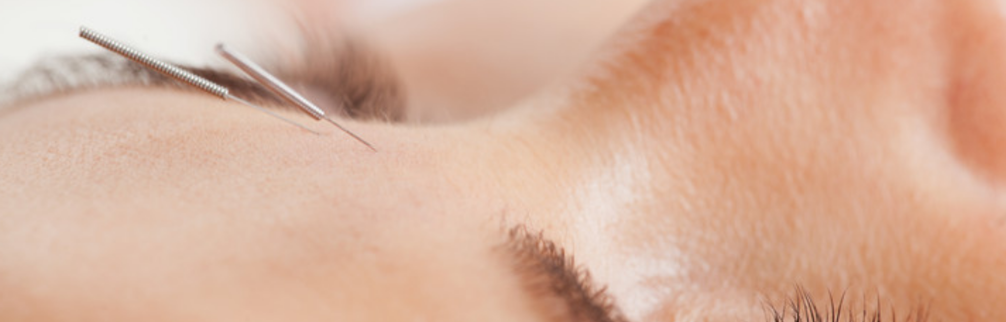 美容鍼灸サロン気月水|埼玉県所沢